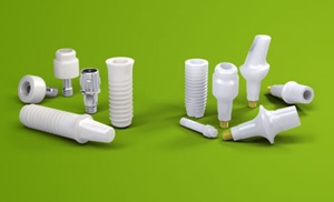 beli zobni implantati Straumann
